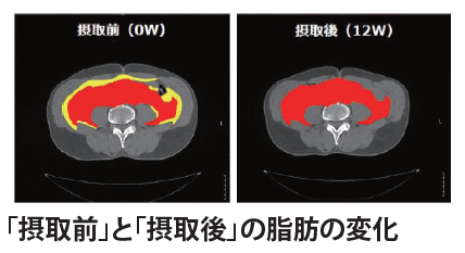 日本臨床實測肚腩位置的內臟脂肪全面消除!